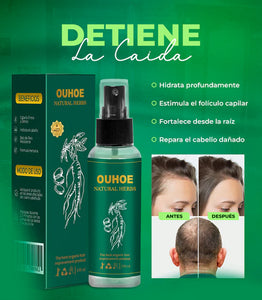 OUHOE ® UNGÜENTO CAPILAR ORIENTAL - NO MÁS CAÍDA DEL CABELLO !
